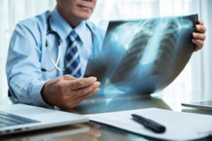 Personal injury lawyer silicosis lung damage